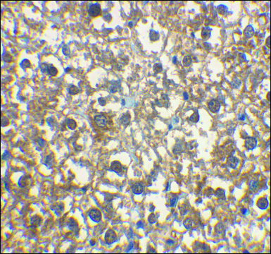 Anti-IRAK-M antibody produced in rabbit
