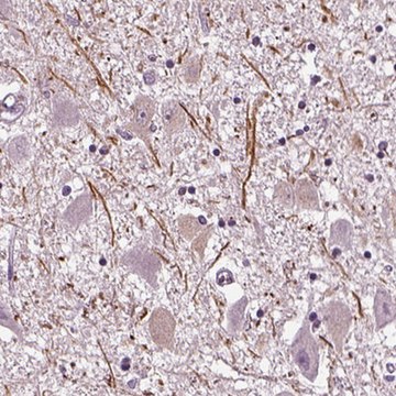 Anti-CNGA3 antibody produced in rabbit