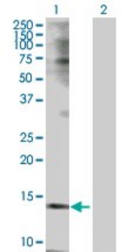 Anti-TSPO antibody produced in rabbit