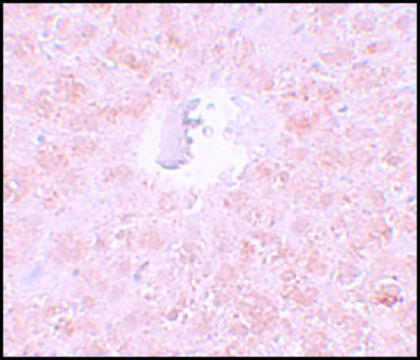 Anti-PIWI-L1 antibody produced in rabbit