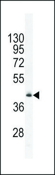 ANTI-RMD1 (N-TERMINAL) antibody produced in