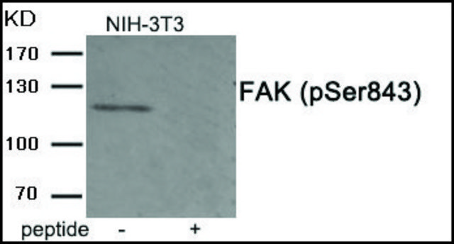 Anti-phospho-FAK (pSer??³) antibody produced in