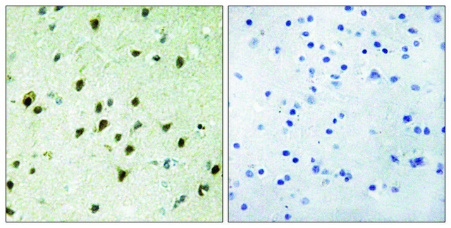 Anti-MAD4 antibody produced in rabbit