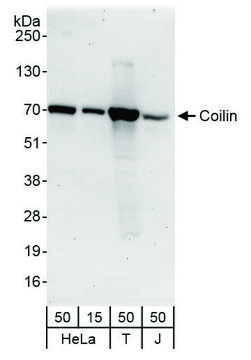 Rabbit anti-Coilin Antibody, Affinity Purified