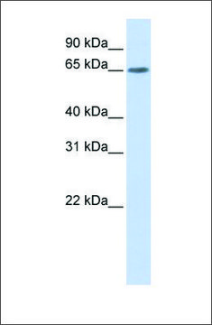 Anti-YTHDF3 antibody produced in rabbit