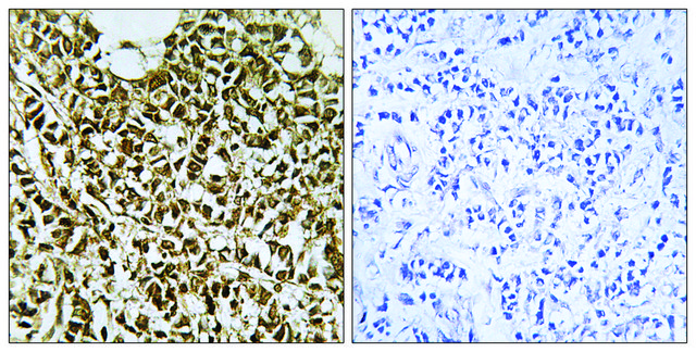 Anti-RPC5 antibody produced in rabbit