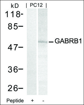 Anti-GABRB1 (Ab-434) antibody produced in
