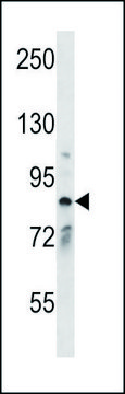 ANTI-CNNM2 (C-TERM) antibody produced in