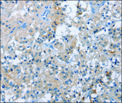 Anti-BTN2A2 antibody produced in rabbit