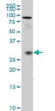 ANTI-TGIF2 antibody produced in mouse