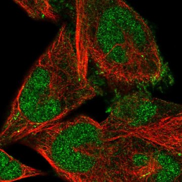 Anti-FBXO41 antibody produced in rabbit