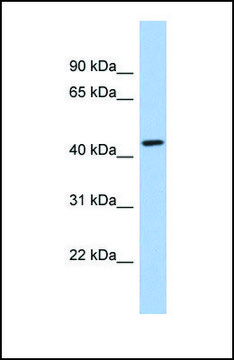 Anti-KCTD10 antibody produced in rabbit