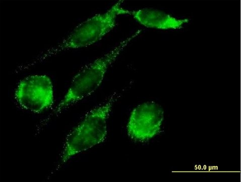 Anti-PECI antibody produced in mouse