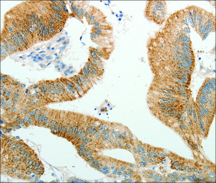 Anti-PGBD5 antibody produced in rabbit