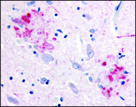 Anti-APP antibody produced in rabbit