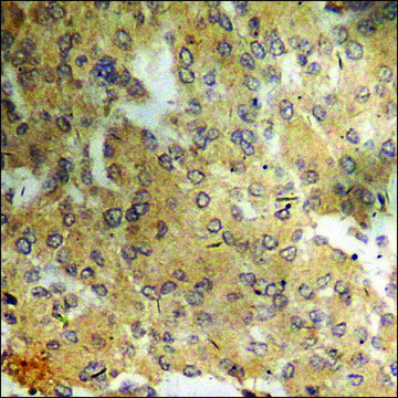 Anti-phospho-ATF4 (pSer²??) antibody produced in