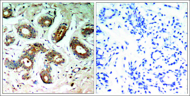 Anti-phospho-YWHAZ (pSer??) antibody produced in