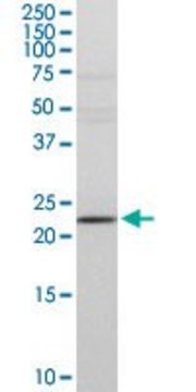 Anti-DTYMK antibody produced in rabbit