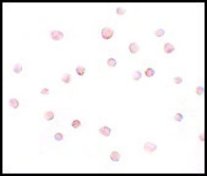 Anti-TCC52 antibody produced in chicken