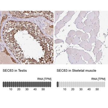 Anti-SEC63 antibody produced in rabbit