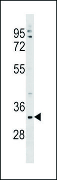 ANTI-TMEM178 (CENTER) antibody produced in
