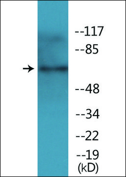 Anti-phospho-TAK1 (pThr¹??) antibody produced in