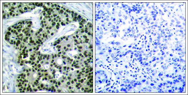 Anti-phospho-HSF1 (pSer³?³) antibody produced in