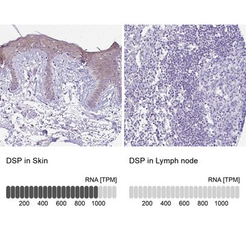 Anti-DSP antibody produced in rabbit