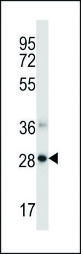 ANTI-NDFIP1 (CENTER) antibody produced in
