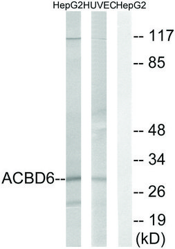 Anti-ACBD6 antibody produced in rabbit