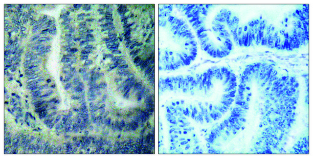 Anti-BAD antibody produced in rabbit