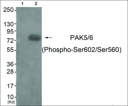 Anti-phospho-PAK5/6 (pSer??²/Ser???) antibody produced in
