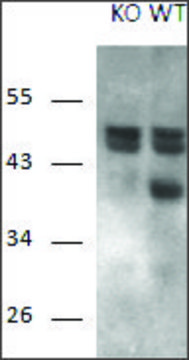Anti-RCAN1 antibody produced in goat