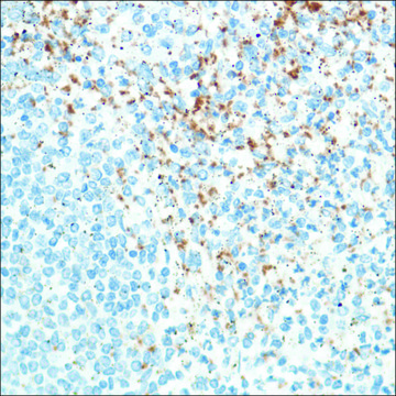 Anti-CD42B antibody, Rabbit monoclonal