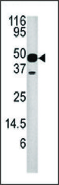 Anti-NUP54 (center A315) antibody produced
