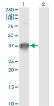 Monoclonal Anti-SPRY1, (N-terminal) antibody produced