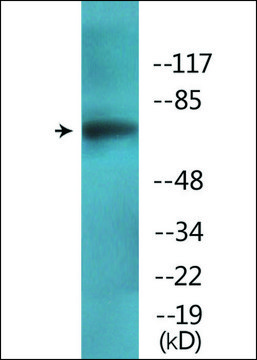 Anti-phospho-PKCD (pTyr??) antibody produced in