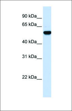 Anti-EEF1A2 antibody produced in rabbit