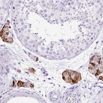 Anti-STOX2 antibody produced in rabbit