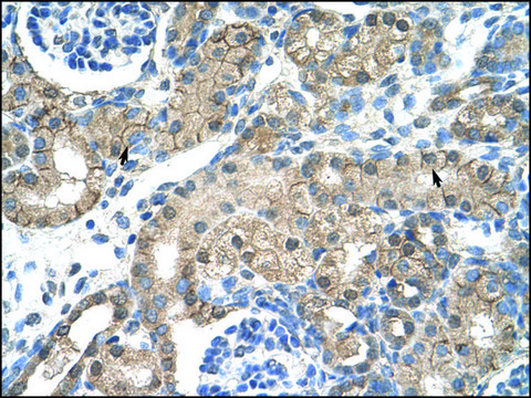 Anti-CHRNB2 antibody produced in rabbit