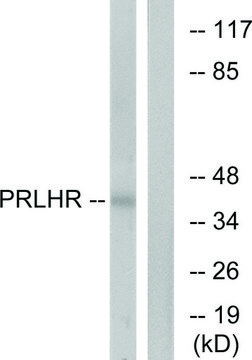Anti-PRLHR antibody produced in rabbit