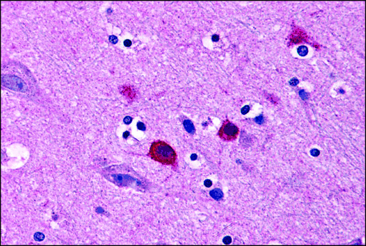 Anti-BOK antibody produced in rabbit