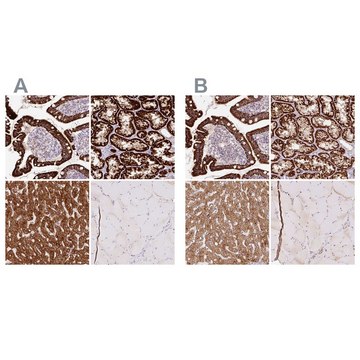 Anti-PCK2 antibody produced in rabbit