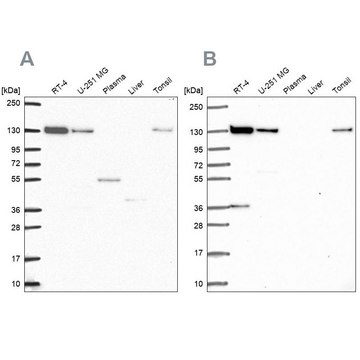 Anti-CAND1 antibody produced in rabbit