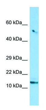 Anti-TCIM (N-terminal) antibody produced in
