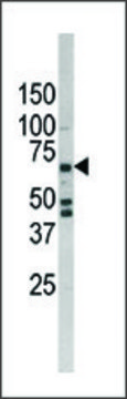 Anti-USP24 (C-term Y1427) antibody produced