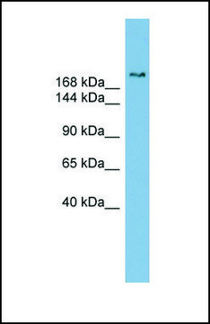 Anti-SETBP1 antibody produced in rabbit