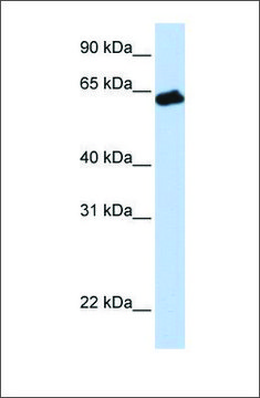 Anti-GHR antibody produced in rabbit