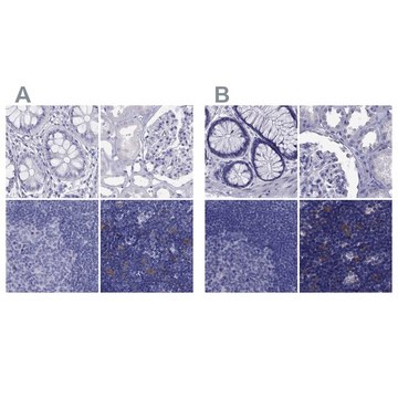 Anti-PSMB11 antibody produced in rabbit