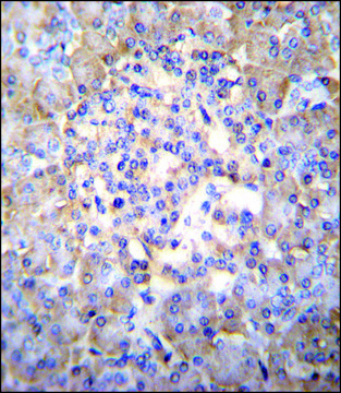 ANTI-TSNARE1 (C-TERM) antibody produced in
